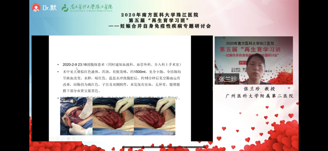 广州医科大学附属第二医院 张兰珍教授.png