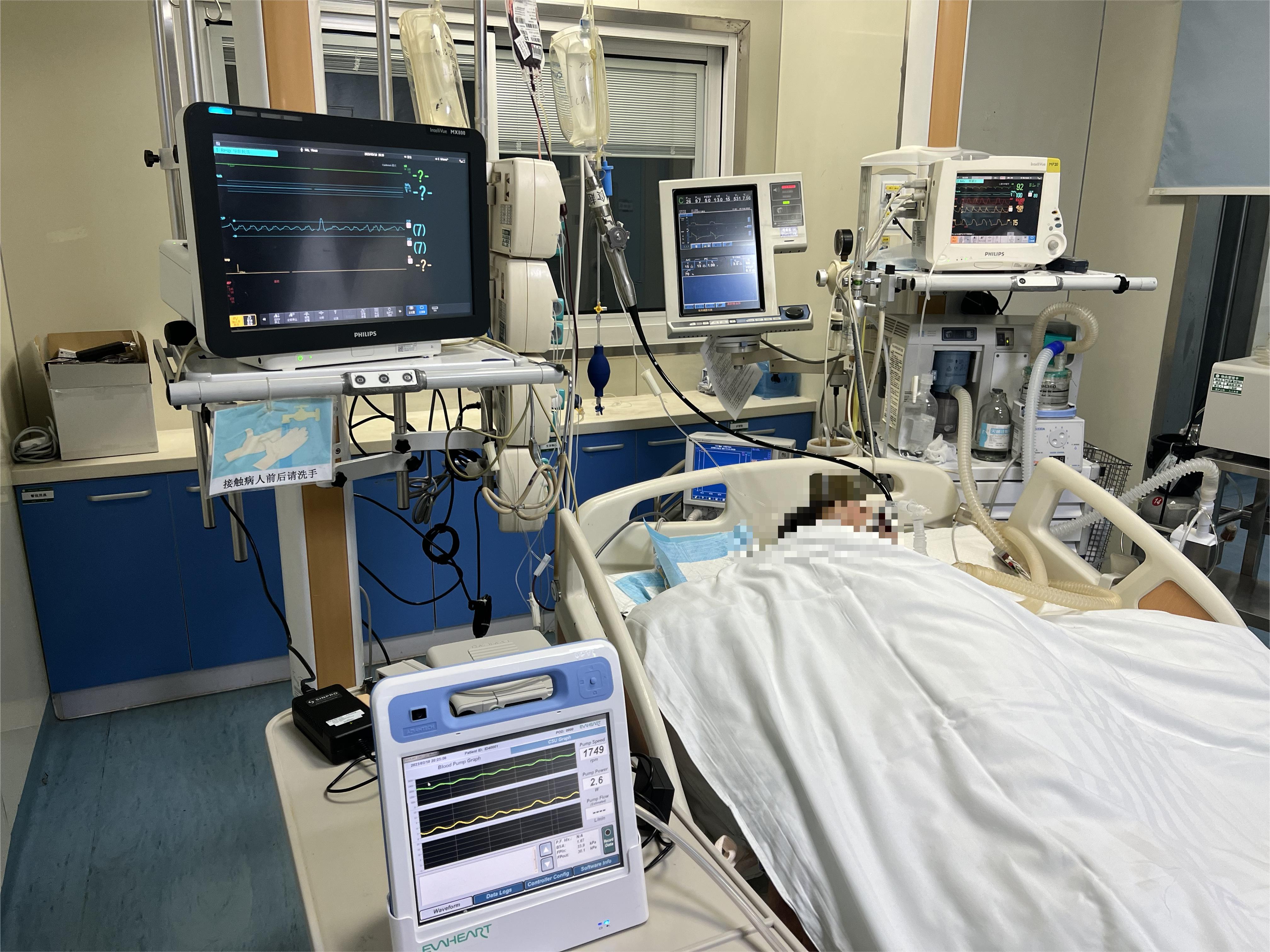 患者术后由ECMO转运团队安全转运至我科进一步救治，患者生命体征平稳，机体恢复良好。