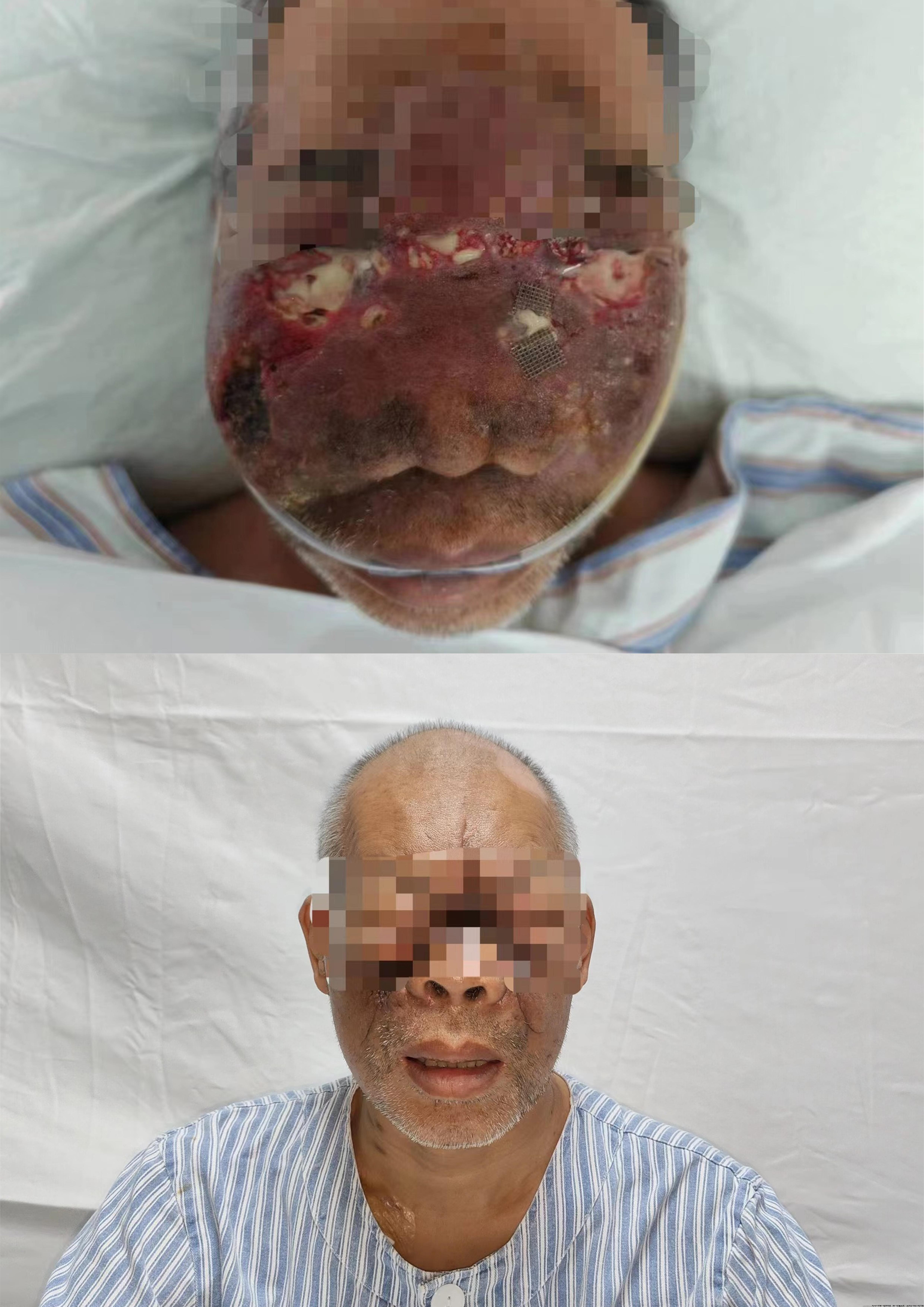 治疗前后.jpg 治疗前后.jpg